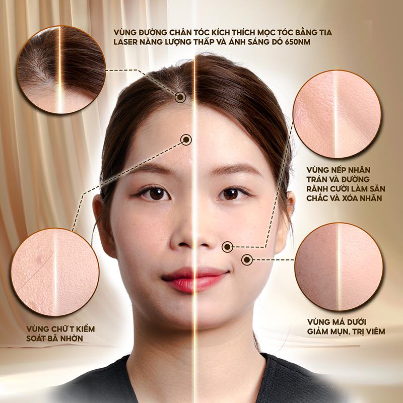 Giải pháp chăm sóc da, đường chân tóc cùng Miro L2 Pro